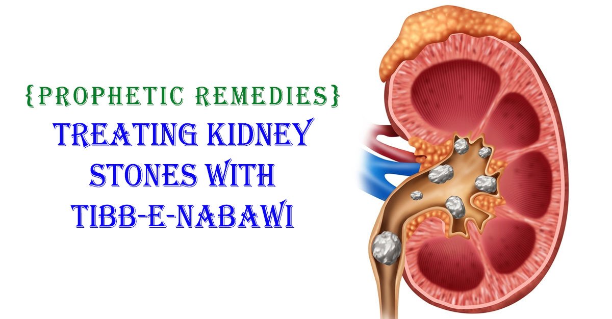 Kidney Stone with Tibb-e-Nabawi